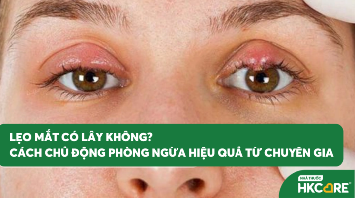 Lẹo mắt có lây không? Và cách chủ động phòng ngừa hiệu quả