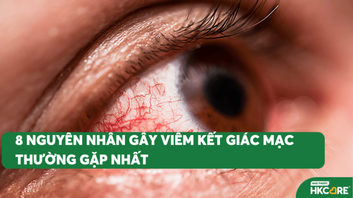 8 nguyên nhân gây viêm kết – giác mạc thường gặp nhất