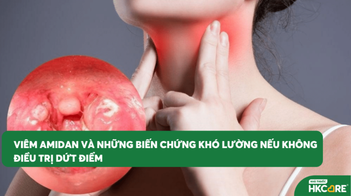 Viêm Amidan và những biến chứng khó lường nếu không điều trị dứt điểm