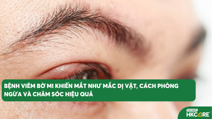 Bệnh viêm bờ mi khiến mắt như mắc dị vật, cách phòng ngừa và chăm sóc hiệu quả