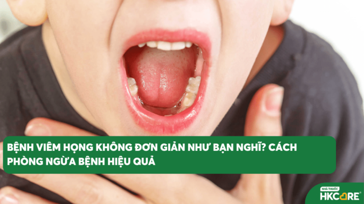 Bệnh viêm họng không đơn giản như bạn nghĩ? Cách phòng ngừa bệnh hiệu quả